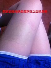 包邮 遮盖纹身疤痕胎记肤色胶布疤痕贴纹身贴运动绷带假皮肤