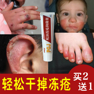 皮管家蛇油冻疮膏特效防手脚耳朵冻痒裂膏脱皮润护手霜冻伤膏正品
