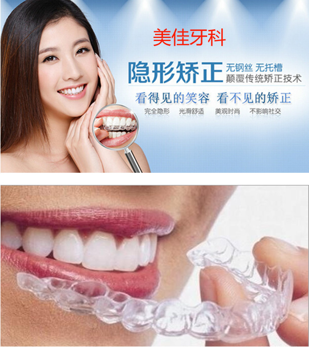 隐形牙齿保持器订做成人牙齿矫正器牙缝大防磨牙软套隐形牙套定制