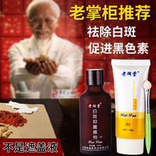 白殿风外用白柏呔徽诟且汉谏素修复白癫疯祛白癜風克星药特效防水