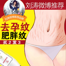 去除肥胖纹淡化生长纹 止痒 保湿 紧致 去妊娠纹修复霜产后消除