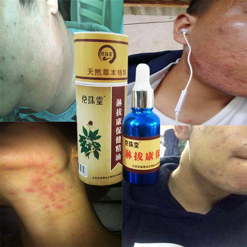 京珠堂淋拔康淋巴排毒按摩精油经络全身刮痧颈部腋下腮腺消除副乳