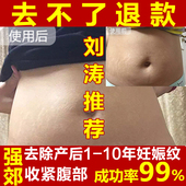 紧致袪肥胖纹 去除妊辰纹产后消除专用去妊娠纹产后修复霜小春正品