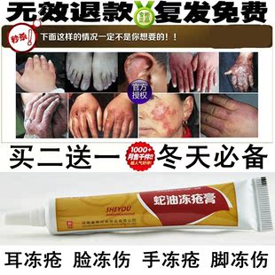 特效蛇油冻疮膏预防止痒去除手脚耳脸伤疤修复冻伤干裂糜烂防裂