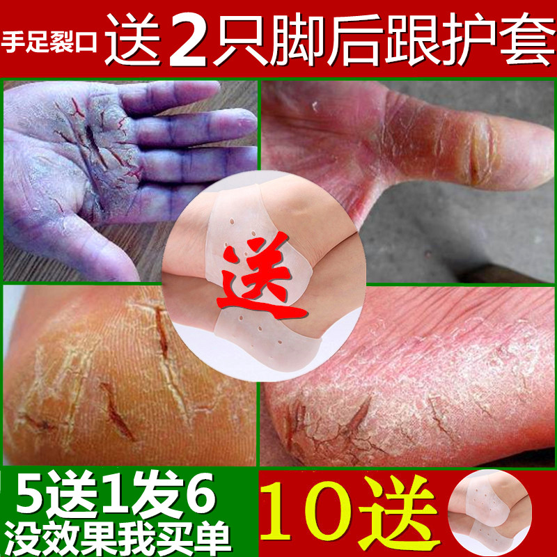 手裂膏 防裂膏 手足干裂脱皮脚后跟裂口手脚开裂龟裂皲裂膏脚裂膏