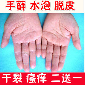 正品[手气]手气的症状图片评测 微信拼手气红包