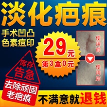 疤痕灵去除黑色素沉淀修复膏手术刀疤凹凸疤痕疙瘩伤疤祛痘印正品