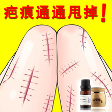去疤痕灵祛摔伤划伤去色素沉淀修复膏凹凸疤痕手术刀疤祛痘印正品