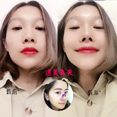 隐形美鼻神器垫鼻器鼻夹挺鼻器翘鼻器瘦鼻翼矫正鼻子高鼻梁增高器
