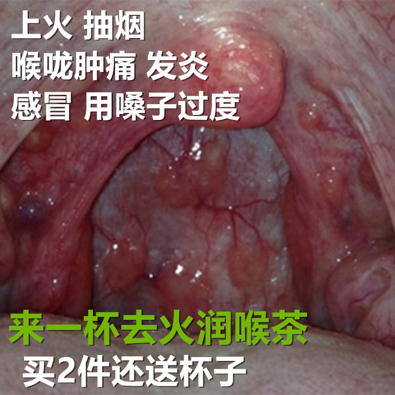【天天特价】胖大海花茶组合润喉茶叶化痰养生茶凉茶去火茶八宝茶