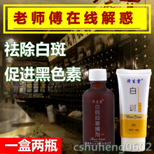 济生堂去白癜風祛白柏咄庥么俸谏素非遮盖液白癫疯特效白殿风克星