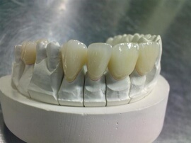 [钛合金瓷牙]评价 钛合金烤瓷牙价格怎么样