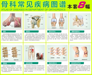 挂图 医院骨科挂图 医学骨科健康图本套8幅 骨科常见疾病图谱 可以