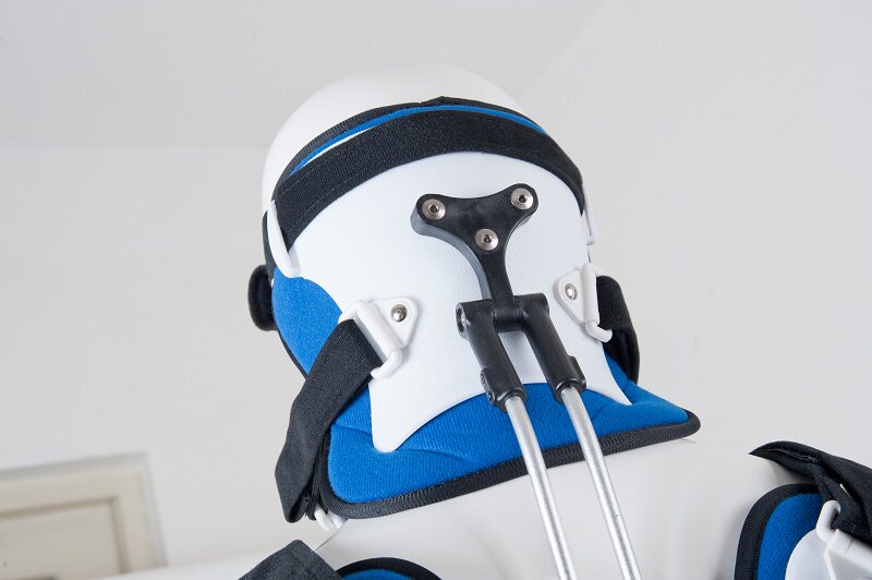 头颈胸矫形器头颈胸成人颈托术后支架固定器头颈胸支架颈椎支具