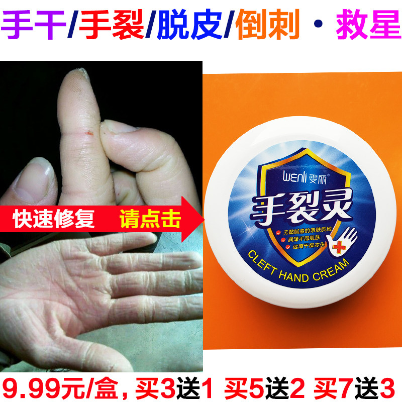 手裂膏,裂宁防裂膏,裂宁膏(第10页)_大山谷图库