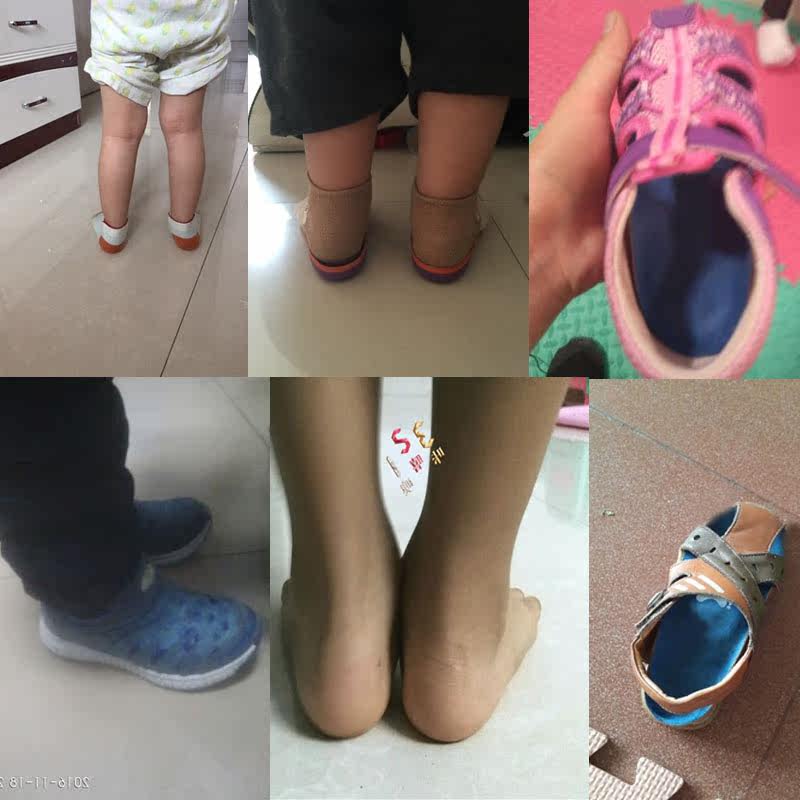 儿童矫正鞋垫内八字扁平足o型腿足弓垫足外翻外八字医用矫正鞋垫